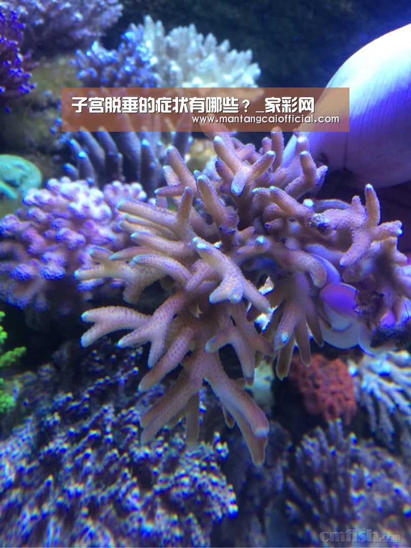 子宫脱垂的症状有哪些?_家彩网(图3) 家彩网走势分析